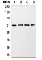 Polyclonal Rabbit anti-Human GSK3A / GSK3 Alpha Antibody (phospho-Ser21, IHC, IF, WB)