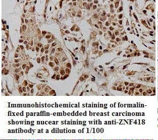 ZNF418 Antibody (aa124-416)