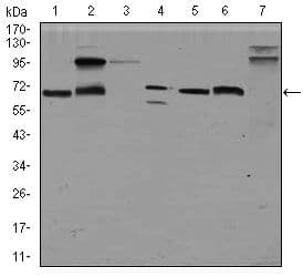 Monoclonal Mouse anti-Human GPC3 / Glypican 3 Antibody (clone 9C2, IHC, IF, WB)