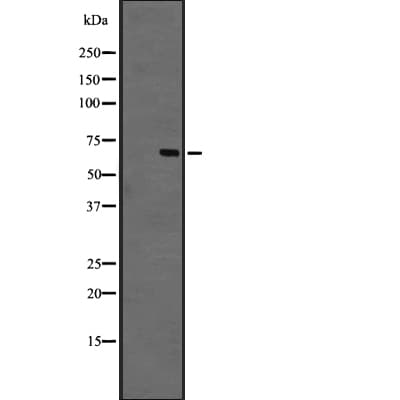 Polyclonal Rabbit anti-Human GPR44 / CRTH2 Antibody (IHC, WB)
