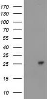 CDKN3 / KAP Antibody (clone OTI1H5)