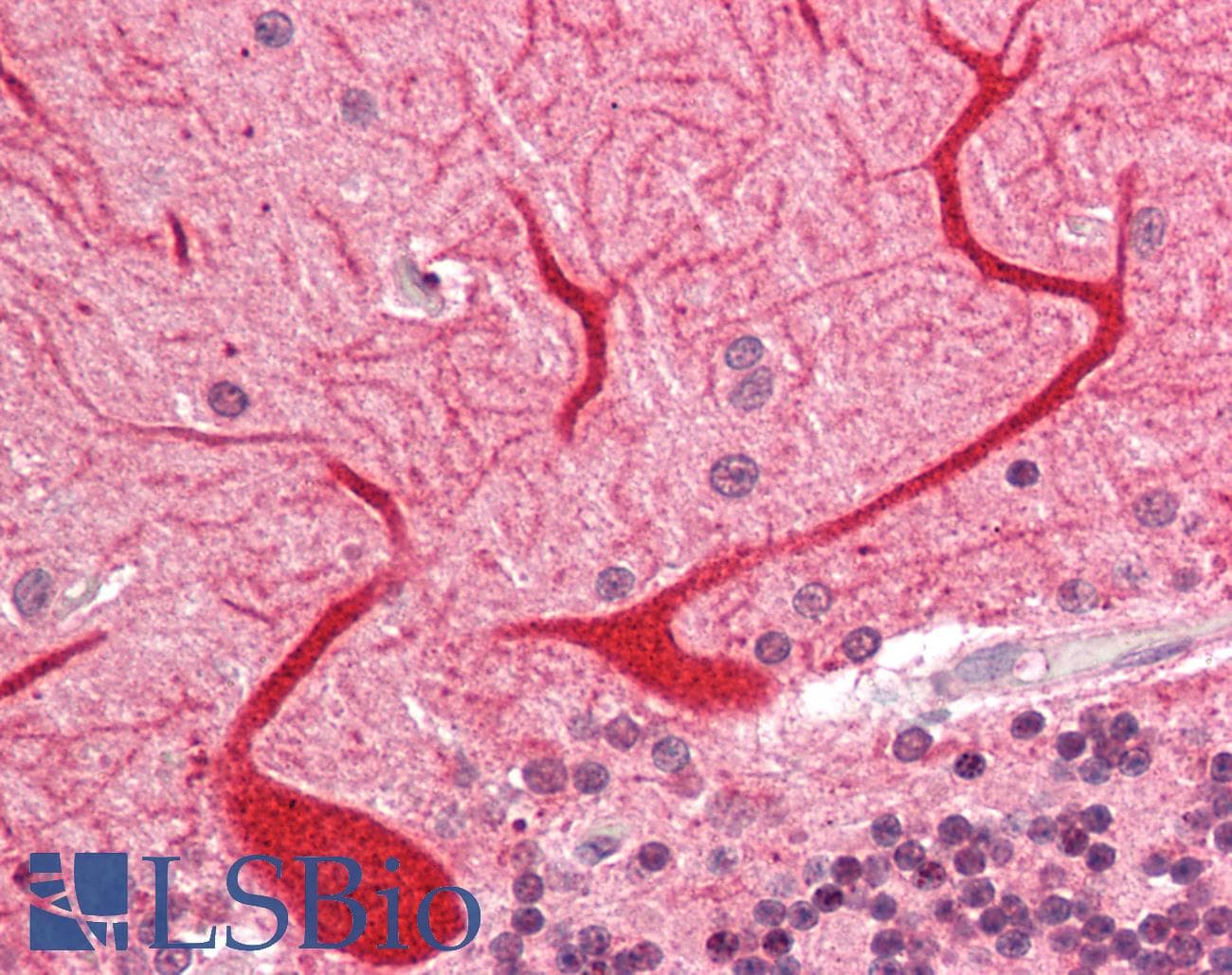 Polyclonal Rabbit anti-Human Proenkephalin / PENK Antibody (aa143-192, IHC, WB)