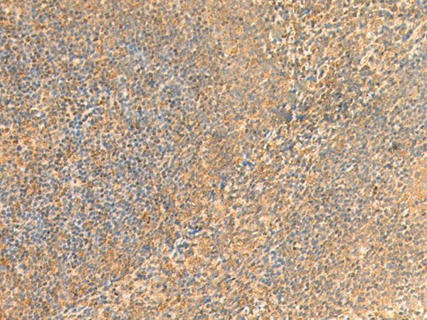 Polyclonal Rabbit anti-Human FAT10 / UBD Antibody (IHC)