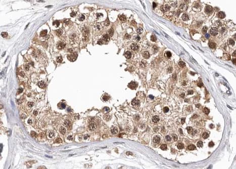 Polyclonal Rabbit anti-Human PKM / Pyruvate Kinase, Muscle Antibody (IHC, IF, WB)