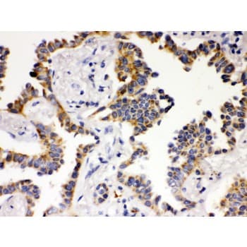 ATG14 Antibody (aa70-101)