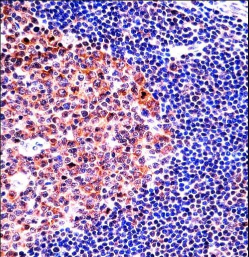 MCM4 Antibody (aa637-665)