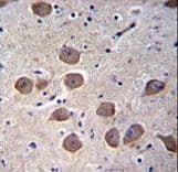 CTNND2 / Delta-2 Catenin Antibody (aa1131-1159)