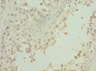 Polyclonal Rabbit anti-Human ZNF350 Antibody (IHC)