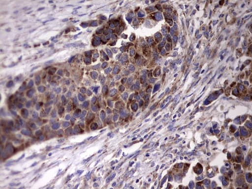 Monoclonal Mouse anti-Human ACE2 / ACE-2 Antibody (clone OTI4D2, aa18-237, IHC, WB)