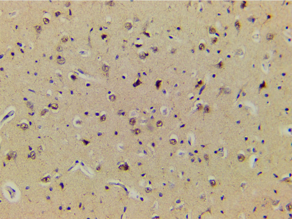 LIMK1 / LIMK Antibody (phospho-Thr508)