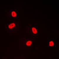 Polyclonal Rabbit anti-Human TFDP1 Antibody (C-Terminus, IHC, IF, WB)