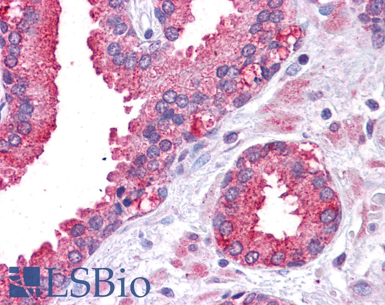 STAT3 Antibody (N-Terminus)
