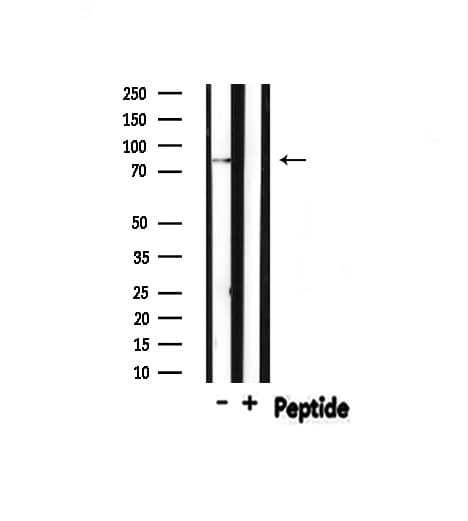 STAT3 Antibody (phospho-Ser727)