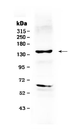 Polyclonal Rabbit anti-Human ERBB2 / HER2 Antibody (IHC, WB)