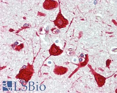 IHC-plus™ PURA / Pur-Alpha Antibody