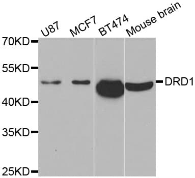 DRD1 / Dopamine Receptor D1 Antibody (aa338-446)