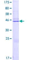 Human CAPSL Protein (Recombinant GST)
