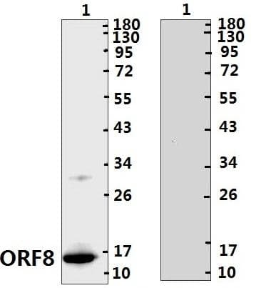 Coronavirus SARS-CoV-2 ORF8 Protein (Recombinant His)