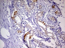 Monoclonal Mouse anti-Human PR / Progesterone Receptor Antibody (clone OTI11E8, aa1-298, IHC, WB)