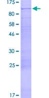 Human EIF2B5 Protein (Recombinant GST)