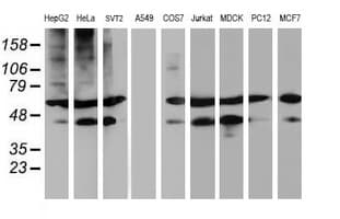 TUBAL3 Antibody (aa150-446, clone OTI5F10, Carrier-free)