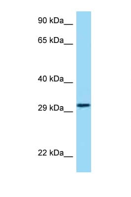 Polyclonal Rabbit anti-Human HRH4 / Histamine H4 Receptor Antibody (aa142-191, WB)