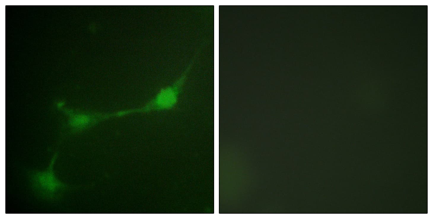 ATXN1 / SCA1 Antibody (phospho-Ser776)