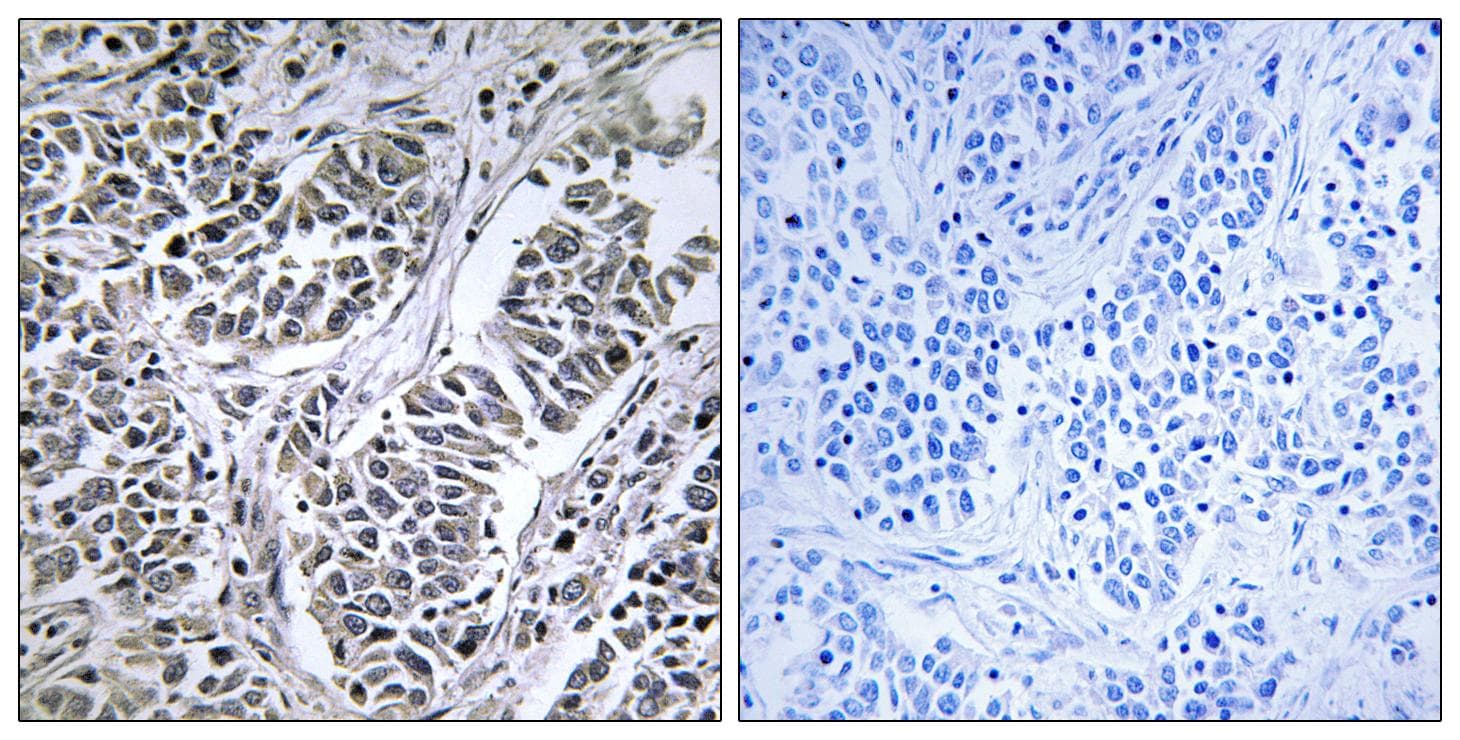 ATP5D Antibody