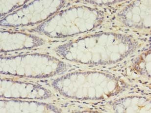 IL2 Antibody