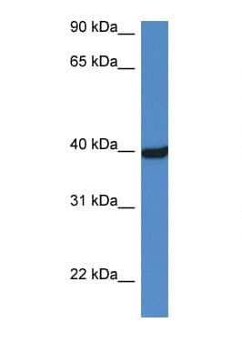 OTC Antibody (aa284-333)