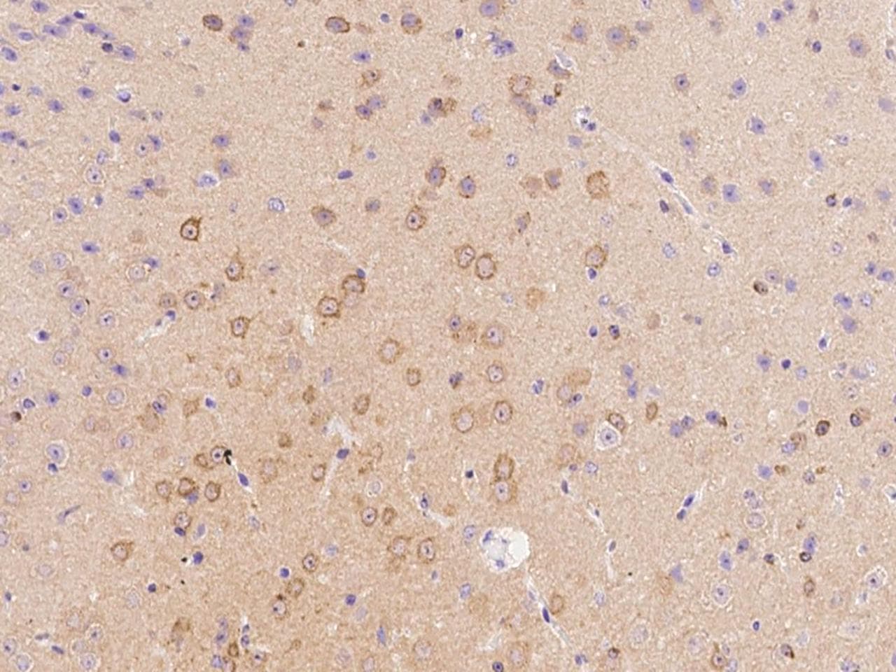 STMN1 / Stathmin / LAG Antibody (Preservative Free)