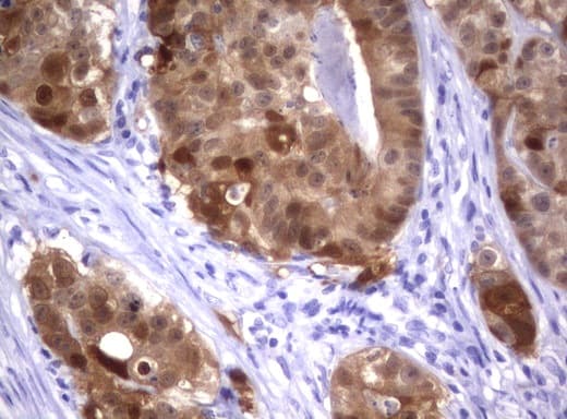 IRF6 Antibody (clone UMAB106, Carrier-free)