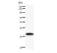 TWIST1 / TWIST Antibody (clone Twist2C1a)
