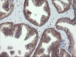 UBE2J1 Antibody (clone OTI1C7)