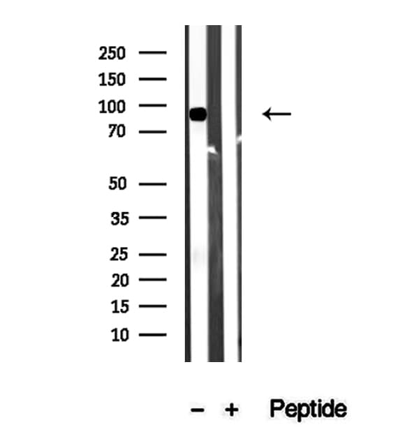 ACO2 / Aconitase 2 Antibody