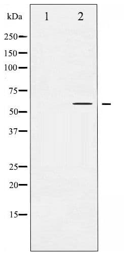 Polyclonal Rabbit anti-Human AKT1 Antibody (phospho-Ser124, IHC, WB)