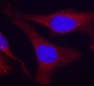 Polyclonal Rabbit anti-Human PTPN6 / SHP1 Antibody (phospho-Tyr536, IHC, IF)