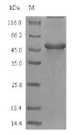 Soy Bean GGH / Gamma-Glutamyl Hydrolase Protein (Recombinant 6His-SUMO, N-terminus)