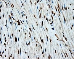Monoclonal Mouse anti-Human APP / Beta Amyloid Precursor Antibody (clone OTI9E2, IHC, IF, WB)