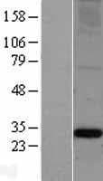 Human APOA1 / Apolipoprotein A 1 (Over-Expression Lysate Myc-DDK (Flag))