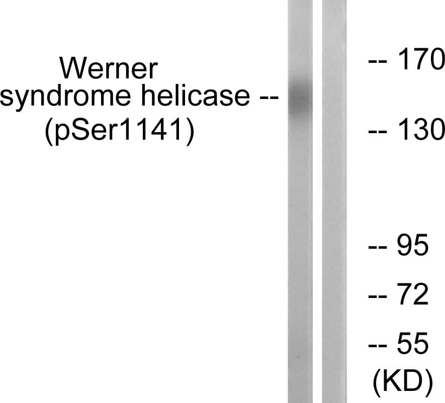 WRN Antibody (phospho-Ser1141)