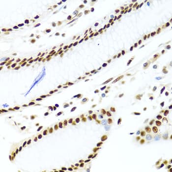 SSB / La Antibody