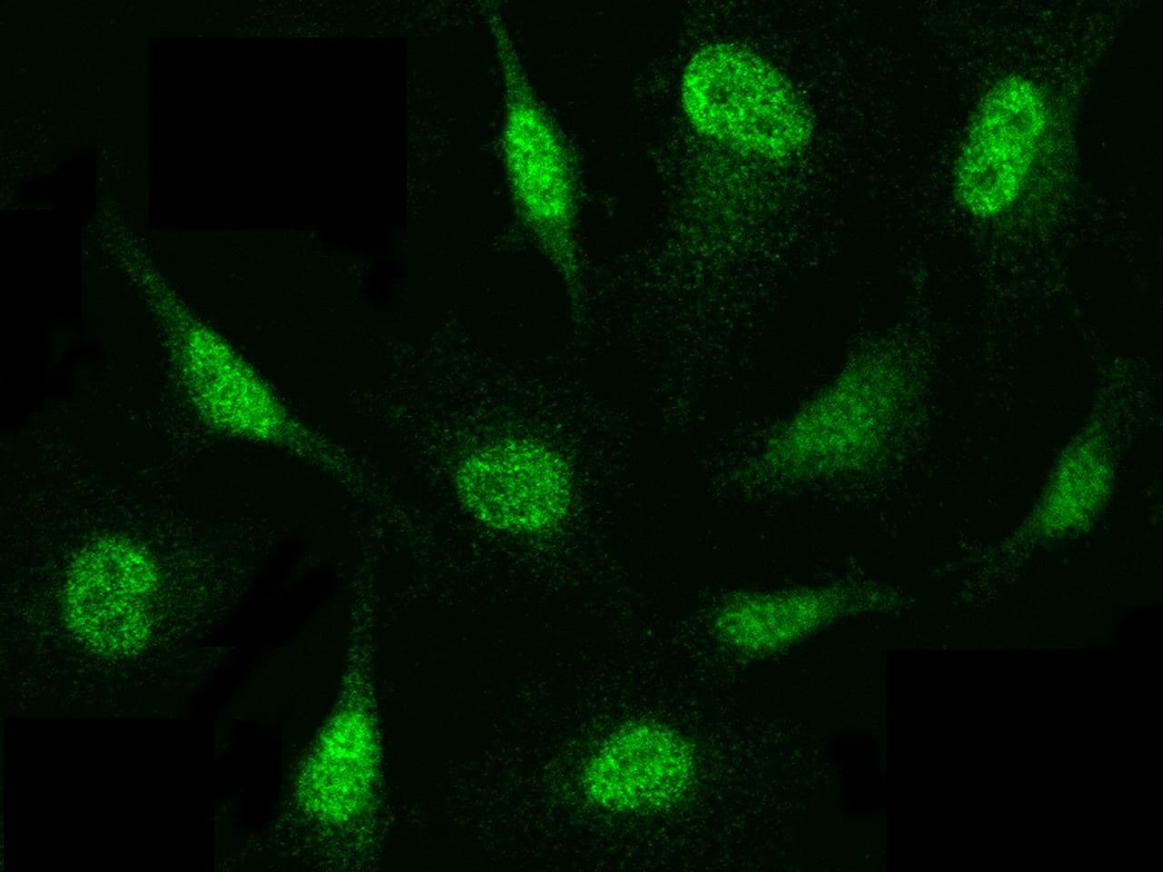 PSMB8 / LMP7 Antibody (Preservative Free)