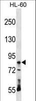 Polyclonal Rabbit anti-Human RAVER1 Antibody (aa56-83, WB)