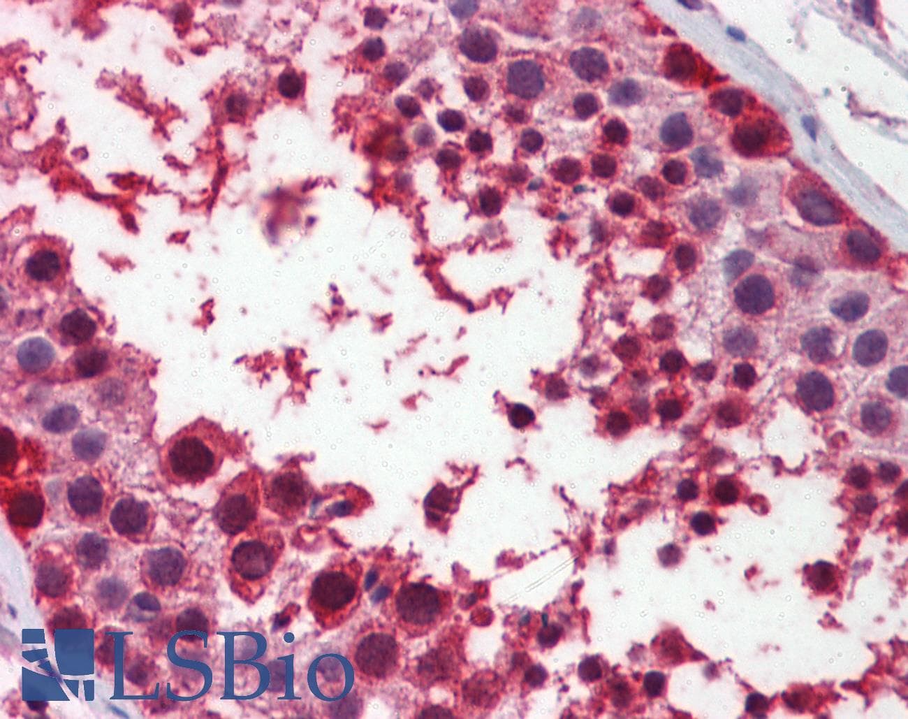 Polyclonal Rabbit anti-Human MDM4 / MDMX Antibody (aa130-179, IHC, WB)