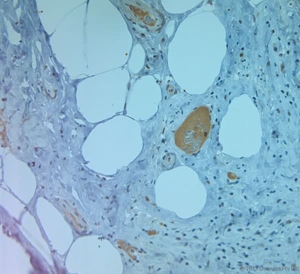 SLC11A2 / DMT1 Antibody