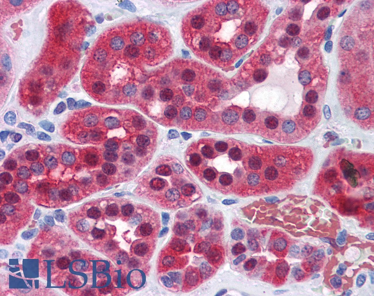 IHC-plus™ Polyclonal Goat anti-Human GPI Antibody (aa120-132, IHC, WB)