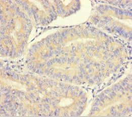 LMAN1L Antibody (aa26-462)