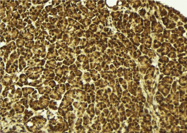 HNRNPDL / hnRNP D Antibody