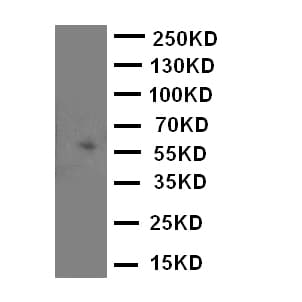 MAOA / Monoamine Oxidase Antibody (aa51-69)